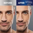 thumbnail image 5 of Retinol Anti-Aging Skincare Daily Moisturizer for Men 1.7 oz, 5 of 9