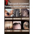 thumbnail image 4 of Productos de aceite para el crecimiento rápido del cabello para hombres y mujeres, reparación eficaz de la calvicie, tratamiento anticaída del cabello, 4 of 5