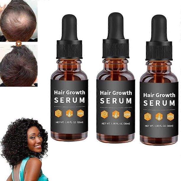 3 unidades de sérum capilar natural a base de hierbas para un cabello más grueso y abundante, y tratamiento anticaída.