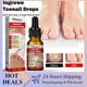 thumbnail image 2 of Ingrown Toenail Treatment Serum Nail Correction Recover Oil Pain Relieve Ingrown Toenail Correction, 2 of 5