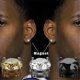 thumbnail image 1 of 1 par de pendientes de magnetoterapia Metiz Lymphvity, 8 mm, plata, 1 of 5