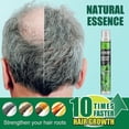 thumbnail image 3 of Sérum en spray de jengibre para el crecimiento del cabello fino y la caída, nutrición profunda del cuero cabelludo, 10 ml, 3 of 5