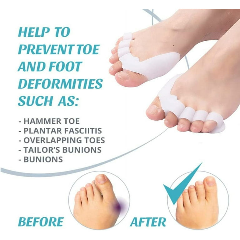 Toe Separators, Relief Pain for Yoga, Gel Five Toes Stretchers for  Overlapping Toes, Easily Wear in Shoes, Sports Activities, Nail Art Salon  Pedicure