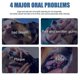thumbnail image 3 of 1-3X Tartar Remover For Dog Natural Dental Care Solution Foam Remove Calculus Reduce Tartar Plaque Buildup Pets Oral Cleaning Product, 3 of 4