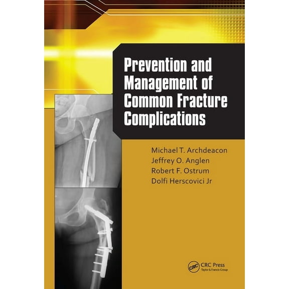 Prevention and Management of Common Fracture Complications, (Hardcover)