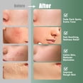 thumbnail image 4 of Almohadillas de tóner Kestper Madecassoside Blemish 110 almohadillas, 4 of 7