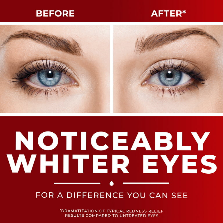 Clear Eyes Maximum Redness Eye Relief Lubricant Eye Drops, 1 fl oz 
