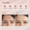 thumbnail image 4 of Radiance by Mist Snail Mucin Serum Anti-Aging Korean Skin Care Face Serum for Women, 50 ml, 4 of 7