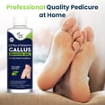 thumbnail image 4 of Foot Cure Callus Remover Gel - 2Pcs Strength Foot Callus Remover Gel with Pumice Stone for Dead Skin, Pedicure Spa Tools(16oz), 4 of 10