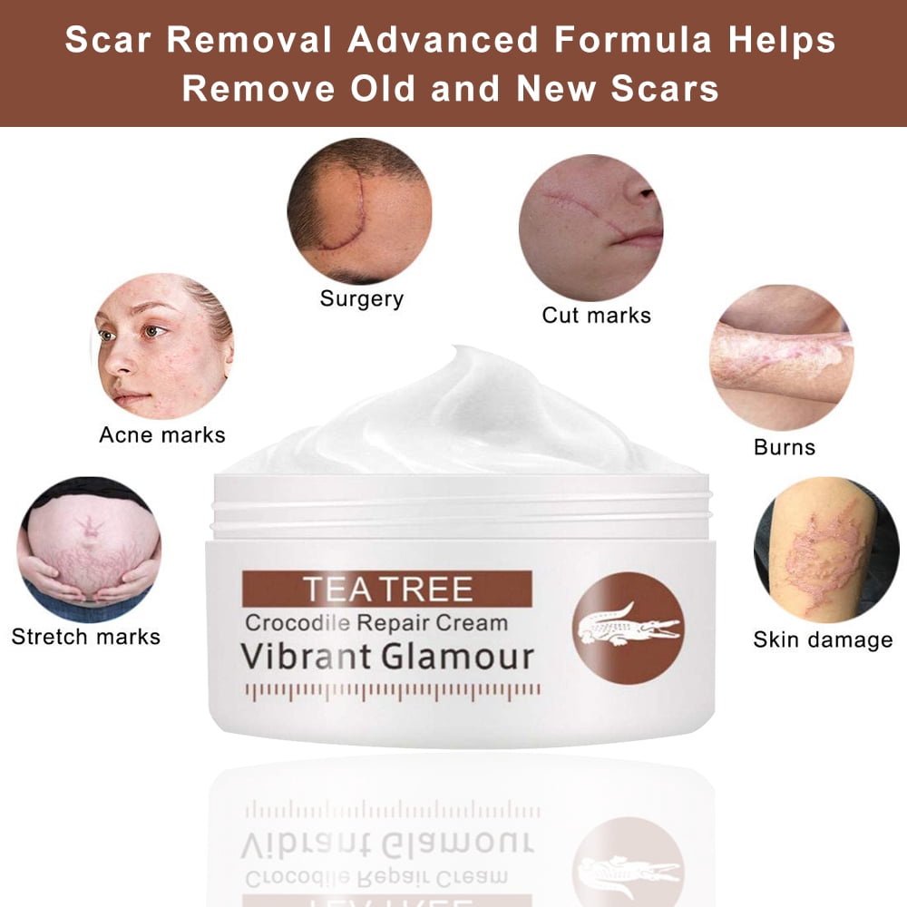 crocodile cream for stretch marks