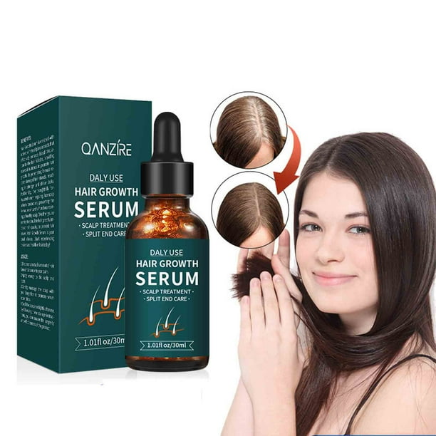 Fiudx Spray Nutritivo Capilar, Extracto de Polygonum Multiflorum, Infusión de Jengibre para El Crecimiento Del Cabello, Regenera El Grosor y La Densidad, Cuidado Diario Del Cuero Cabelludo, Previene