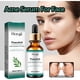 thumbnail image 1 of Fiudx Ofertas Flash Del Día Solo En Línea Suero Para Mejorar La Textura General De La Piel Que Encoge Los Poros 30 Ml, 1 of 6