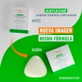 thumbnail image 3 of Antiacné Jabón Dermolimpiador 100 g blanco, 3 of 9
