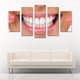 thumbnail image 2 of Juego de Cuadros Decorativos, Sonrisa Perfecta y Radiante, Estilo Estética Dental, 5 Piezas, Ideal para Clínicas de Diseño de Sonrisa, 150x80cm, 2 of 5