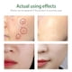 thumbnail image 3 of Clearance, Natural Facial Cleansing Foam Oil Control Acne Cleanser, 3 of 4