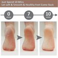 thumbnail image 5 of Pedicure Foot File Callus Remover -Large Foot Rasp Colossal Foot Scrubber Professional Stainless Steel Callus File for Wet and Dry Feet, 5 of 5