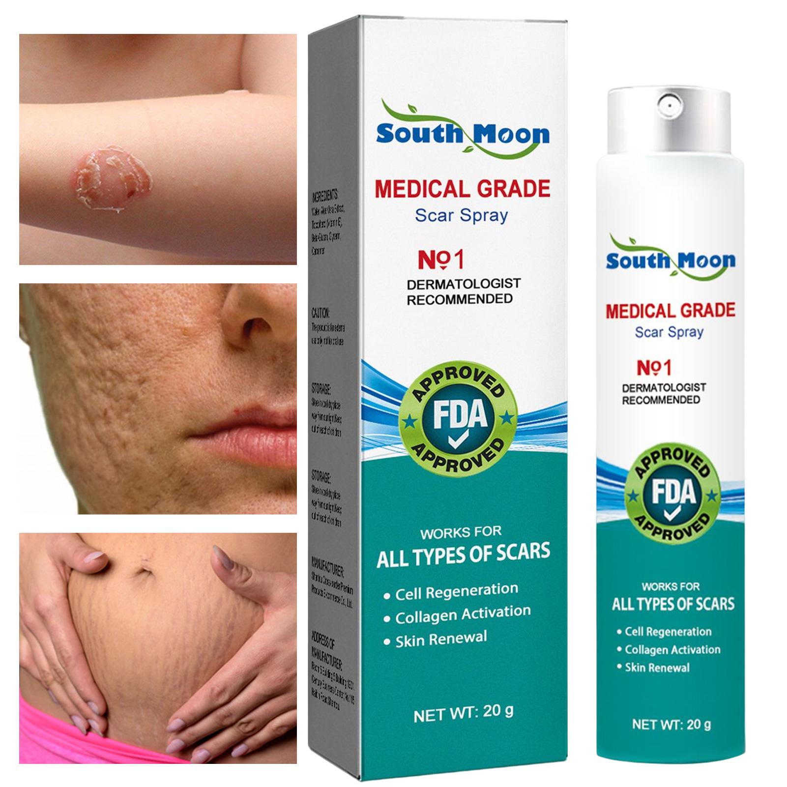Scar Removal Spray Stretch Mark Reduction Spray Skin Body Repair