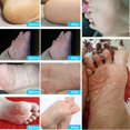 thumbnail image 4 of 1 par de mascarillas exfoliantes para pies, pedicura, removedor de piel muerta (leche) Ndcxsfigh Cuidado Belleza, 4 of 9