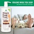 Miracle of Aloe, Miracle Foot Repair Cream with 60 UltraAloe 32 ounce