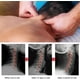 thumbnail image 4 of Fiudx Masajeador Trapecio, Herramienta Portátil de Presión Digital, Dispositivo para Aliviar El Dolor de Cuello y Espalda, Ayuda para Liberar La Tensión Muscular, Alivia El Estrés y El Dolor de Cabez, 4 of 6