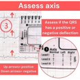 thumbnail image 5 of ECG/EKG Règle 7 Étapes pour Interprétation ECG/EKG, Règle de Carte EKG Portable, 5 of 5