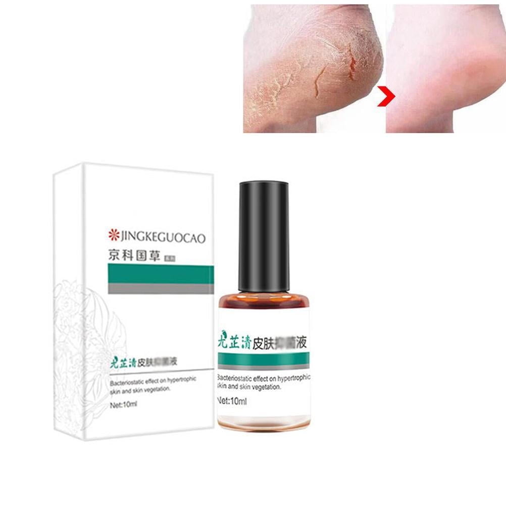 Corn Removal Extra Strengthen Gel Quick Corn Remover Liquid Mild Corn