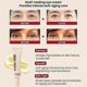 thumbnail image 4 of Anti-Aging Eye Cream with 4% Liposomal Retinal and Soy Ferments, Intensive Treatment of Wrinkles, Dark Circles and Bags Under the Eyes, Light Texture, 4 of 5