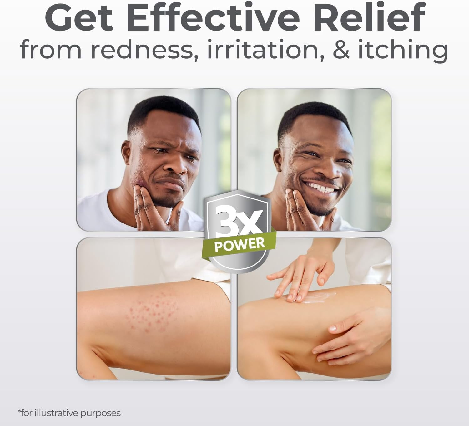 Terrasil Folliculitis Cream, Folliculitis Treatment of Ingrown Hair, Itch Relief, Clinically Proven 1% Clotrimazole, Natural Ingredients, Scalp, Face & Body, Dermatologist Tested. (1.7 oz)