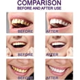 thumbnail image 5 of Hismile V34 Colour Corrector Teeth Whitening Gel Pen, Tooth Stain Removal 1-10pcs, 5 of 5