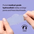 thumbnail image 4 of QARUN Nose Pore Patches (7 Ct),Blackhead Remover Strip,Overnight Blackhead Remover-Pore Strips-Absorbs Gunk-Thin,Flexible&Painless-Hydrocolloid Patches, 4 of 8