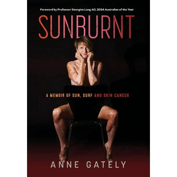 Sunburnt: A memoir of sun, surf and skin cancer, (Hardcover)
