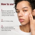 thumbnail image 2 of Folliculitis Treatment Cream, Fast-Acting Relief for Scalp, Face & Body, Soothes Itching, Redness & Inflammation, Natural Colloidal Oatmeal Formula for Sensitive Skin - 3.52oz, 2 of 9
