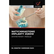 Natychmiastowe Implanty Zbw (Paperback)