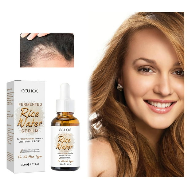 Fermented Rice Water Rice Water For Hair Growth Rice Water Hair Growth