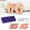 thumbnail image 2 of Pumice Stone Callus Remover Eliminator Foot Scrubber Exfoliator Dead Skin Remover Pedicure Tool, 2 of 5