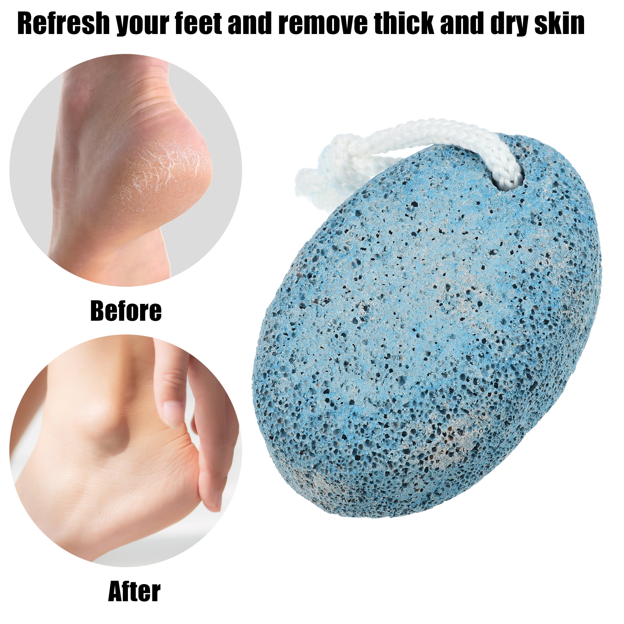 Unique Bargains 2 Pcs Foot Care Exfoliating Scrub Stone Pumice Stone Foot File Blue