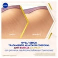 thumbnail image 4 of Sérum NIVEA Luminous 630 tratamiento avanzado anti estrías 100 ml, 4 of 11