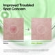 thumbnail image 5 of Tónico aclarador de piel Anua Azelaic Acid 3 CICA, cuidado calmante y clarificante, con ácido salicílico y ácido azelaico, cuidado de sebo e imperfecciones, apto para piel sensible, cuidado de la piel, 5 of 8