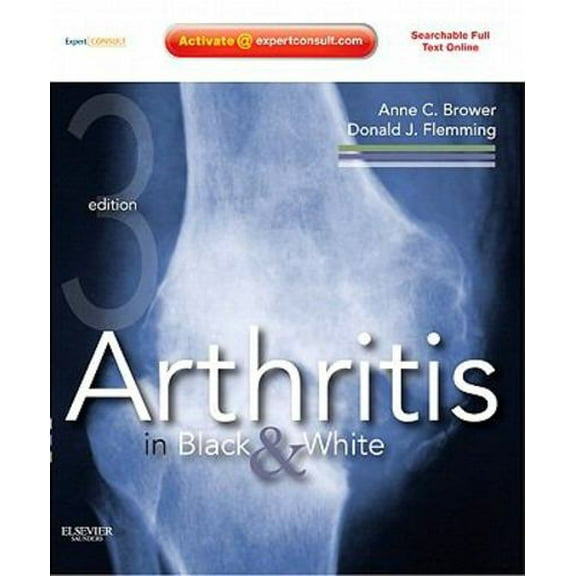 Arthritis in Black & White (Hardcover) by Anne C Brower, Donald J Flemming
