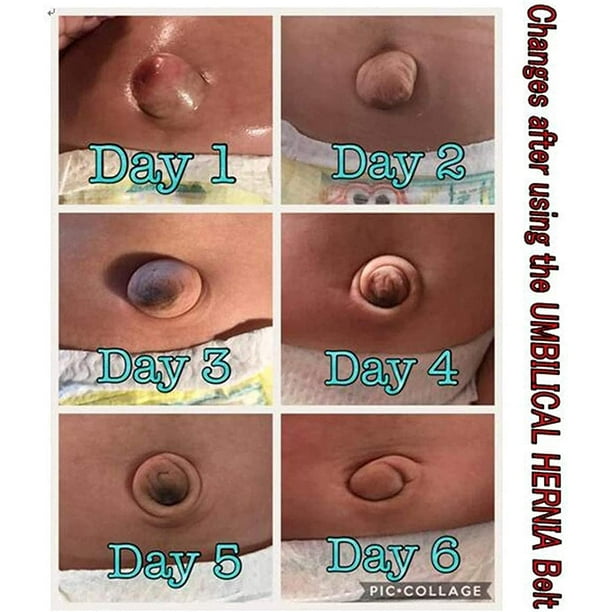 Belt for baby belly button sale
