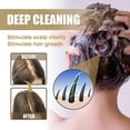 thumbnail image 3 of Champú y jabón con granos de avena EELHOE para el cuidado del cabello, limpieza del cuero cabelludo, cuidado anticaída del cabello, champú y jabón para el crecimiento del cabello | 3082261945747, 3 of 4