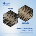 thumbnail image 5 of Shampoo Head & Shoulders Anti-Resequedad Nutrición Diaria, Miel Aceites y Esenciales 375 ml, 5 of 5