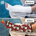 thumbnail image 7 of COEQINE Christmas Holly Leg Cast Cover 2 Pack Small Below The Knee Leg Cast Sleeve Broken Leg Shower Cast Cover Adjustable Short Foot Cast Cover Christmas Gifts for Kids Girls, 7 of 7