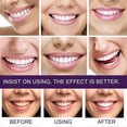 thumbnail image 4 of V34 Purple Teeth Whitening Toothpaste, Tooth Stain Removal and Booster, Tooth Foam, Toothpaste NEW, 4 of 4