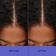 SheaMoisture Anti-Dandruff Shampoo For Removing Buildup Apple Cider Vinegar & Salicylic Acid System for a Healthier Scalp, 13 fl oz