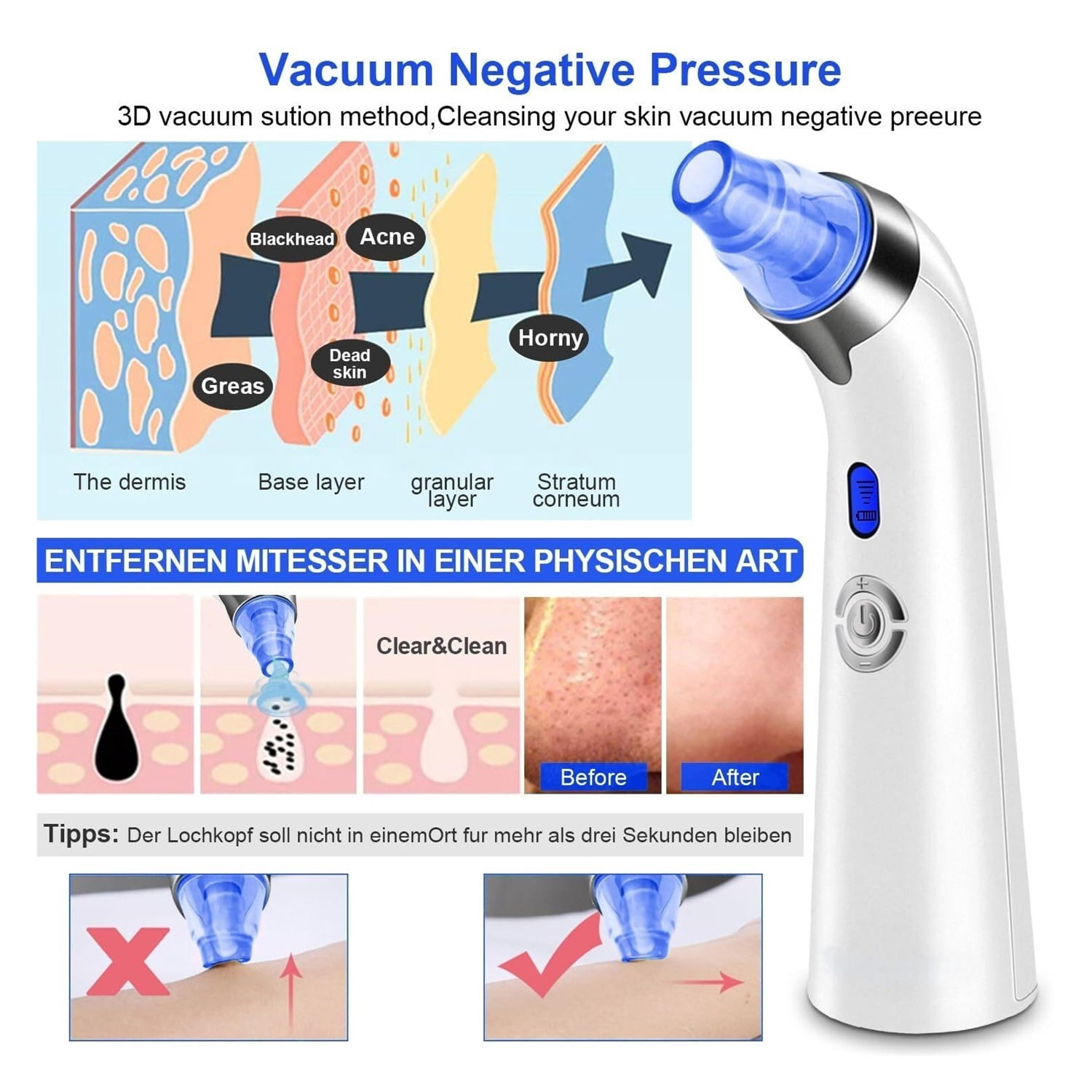 Blackhead Remover Pore Vacuum, Face Suction Pore Cleaner, 5 Suction Power Electric Blackhead Extractor Tool, 4 Probes, Blackhead Suction Remover for Women & Men