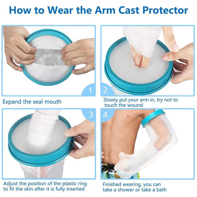 Kids Arm Cast Cover Per Doccia Bagno Adolescenti Impermeabile E A Tenuta Stagna Cast Bandage Protector Bag Per Rotto Chirurgia Ferita Braccio Mani Polsi Protector B