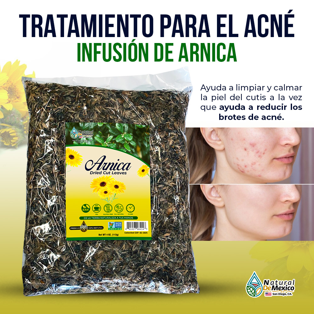 Arnica Herbal/Tea 4 Oz, Infusion Herbs Tea, Para Tratar el Acné