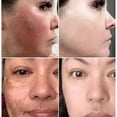 thumbnail image 2 of Suero blanqueador facial con vitamina C, elimina manchas oscuras, pecas, Retinol de melanina, esencia antiarrugas, brillo, cuidado de la piel coreano, 2 of 5