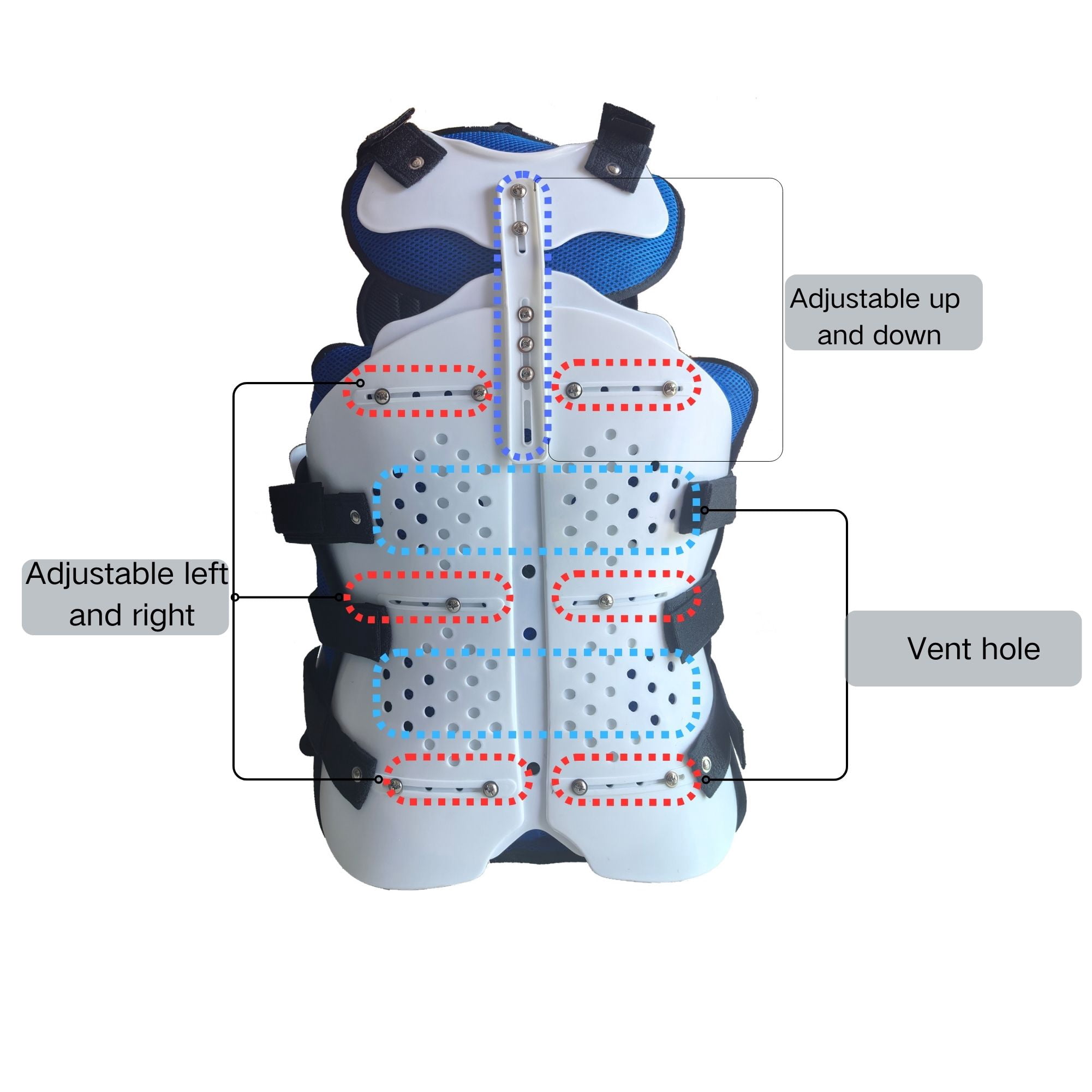 TLSO Inflatable Thoracolumbar Fixed Back Spinal Brace, Straightener for Fractures Mild Scoliosis & Post Surgery Support